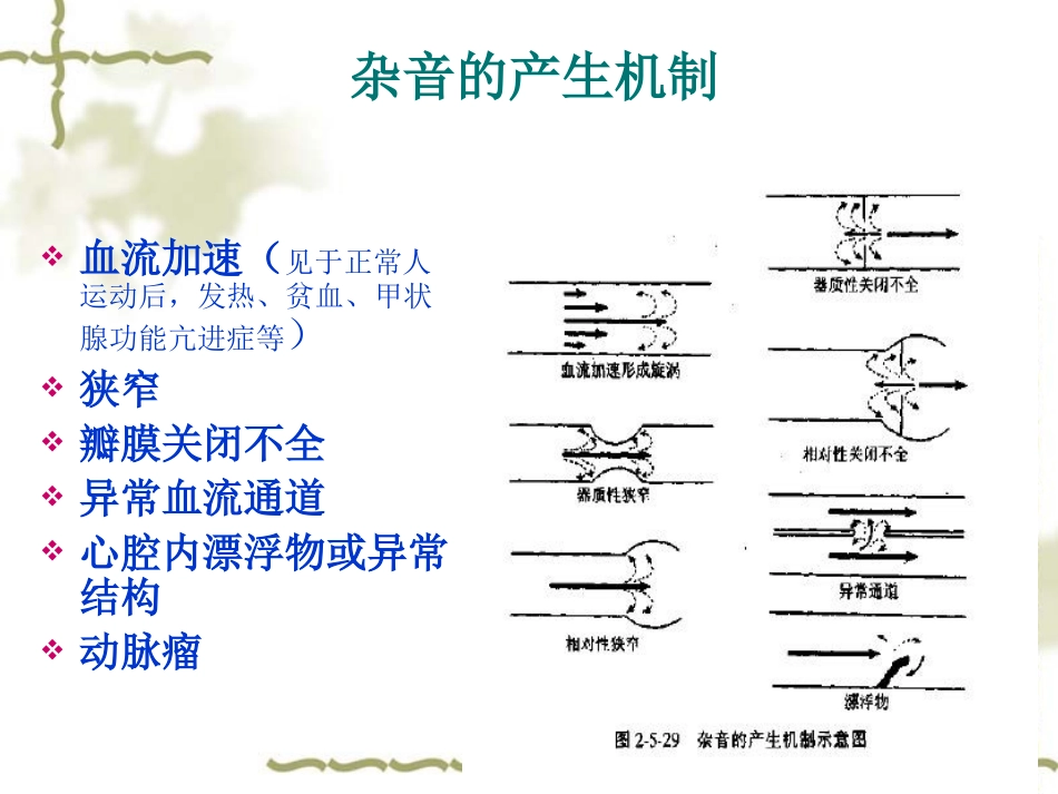 心脏听诊2五年制.ppt_第3页