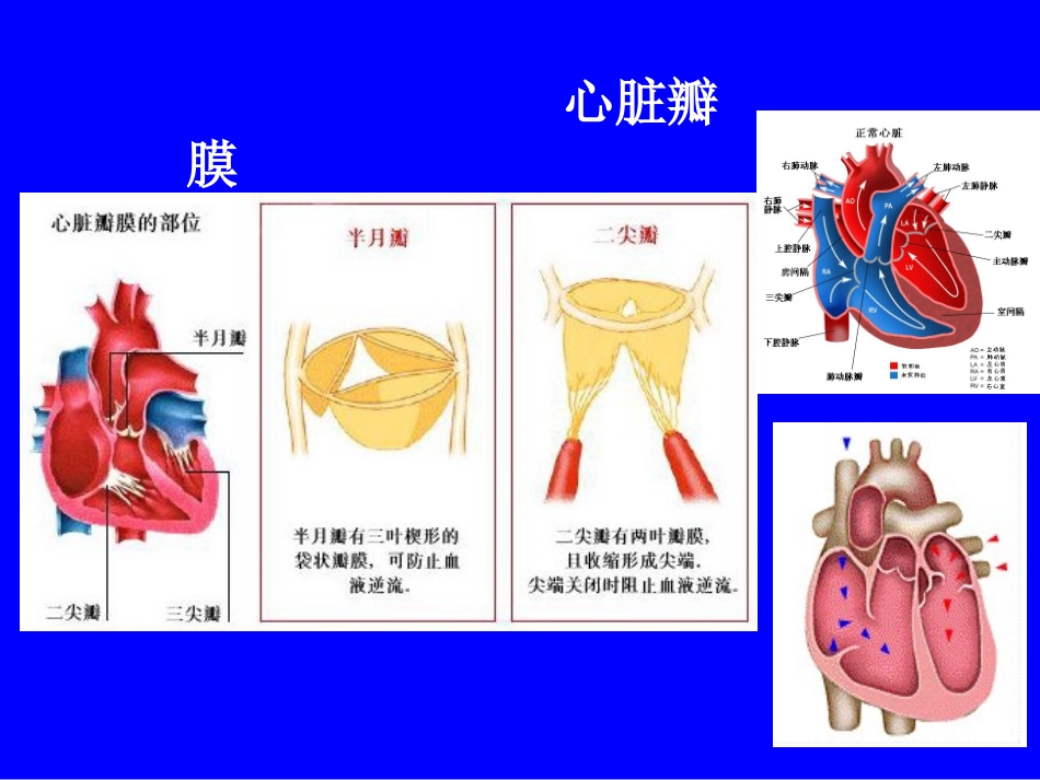 心脏瓣膜病(二尖瓣狭窄)2014.ppt_第2页