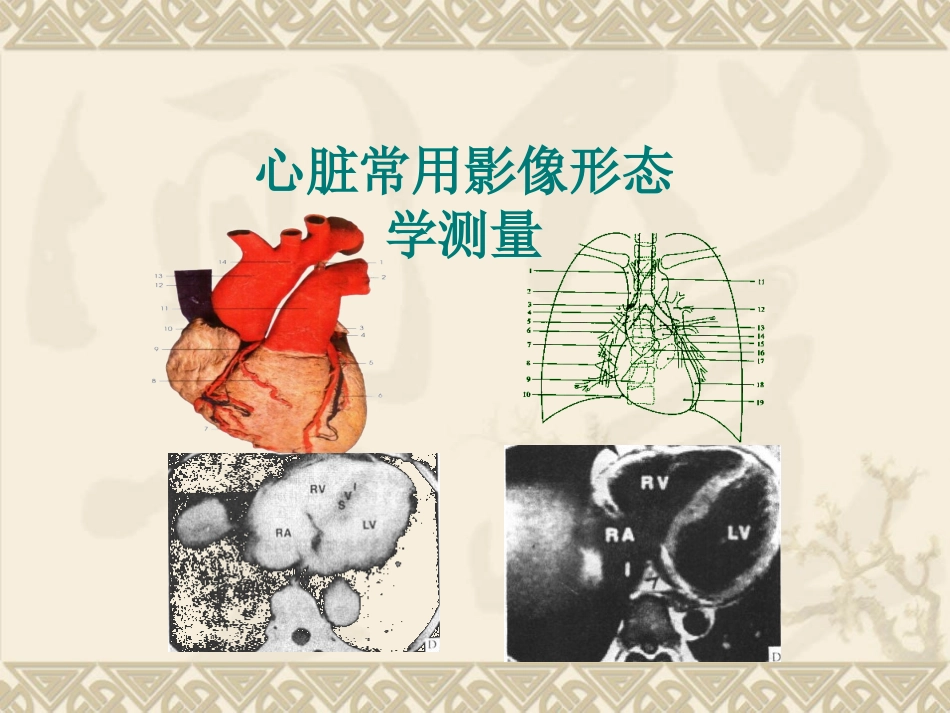 心脏影像形态学测量.ppt_第1页