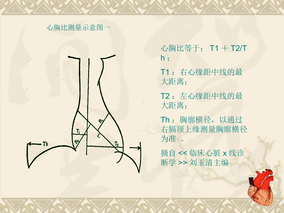 心脏影像形态学测量.ppt_第3页