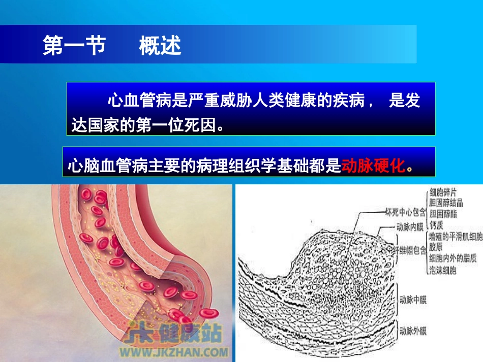 心脏病的检测.ppt_第3页