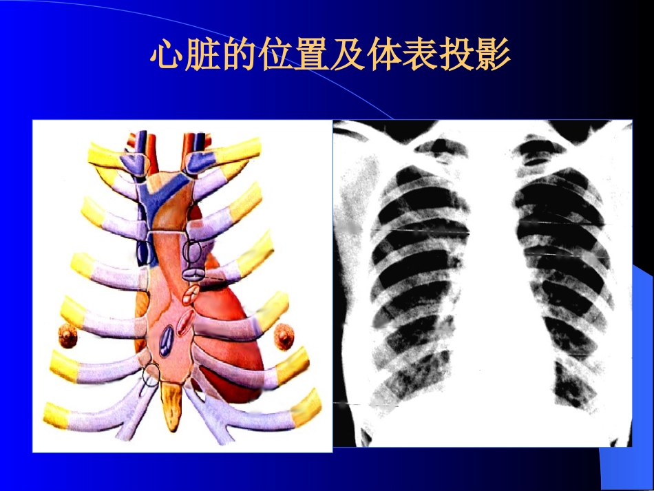 心脏超声总论.ppt_第3页