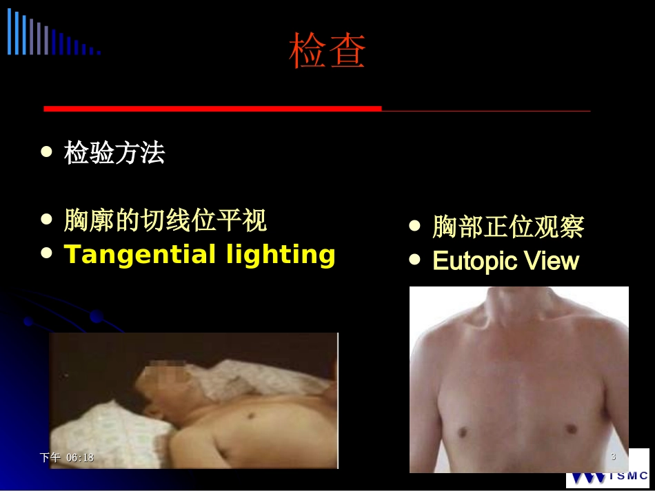 心脏查体.ppt_第3页