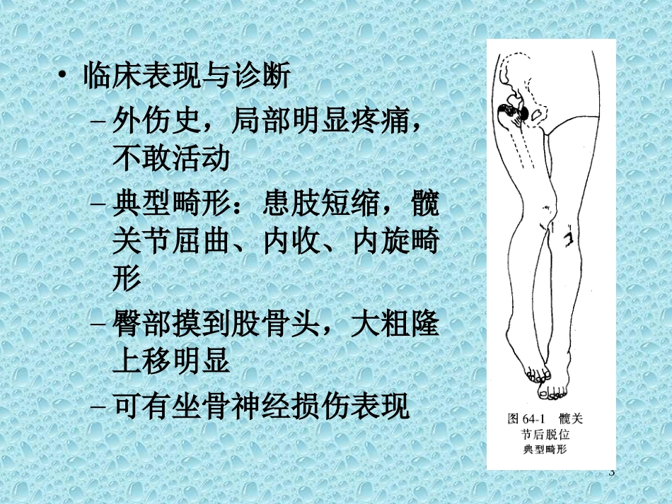 下肢骨、关节损伤.ppt_第3页