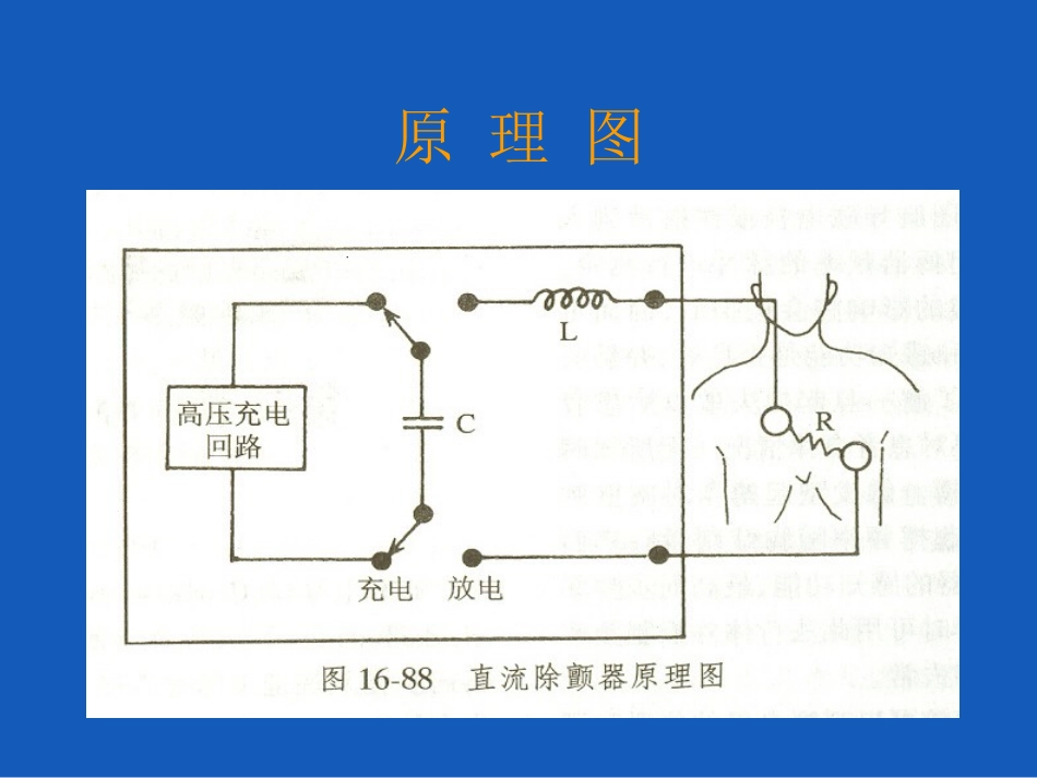 心脏电除颤术(Lee).ppt_第3页