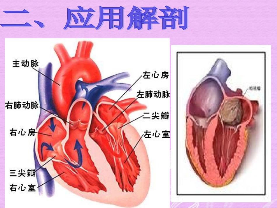 心脏粘液瘤手术配合.ppt_第3页