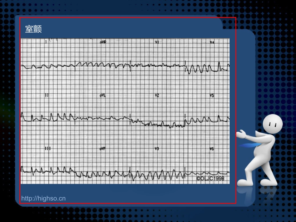 心脏骤停和心脏性猝死.ppt_第2页