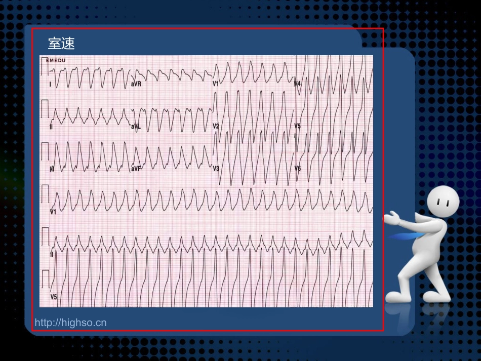 心脏骤停和心脏性猝死.ppt_第3页