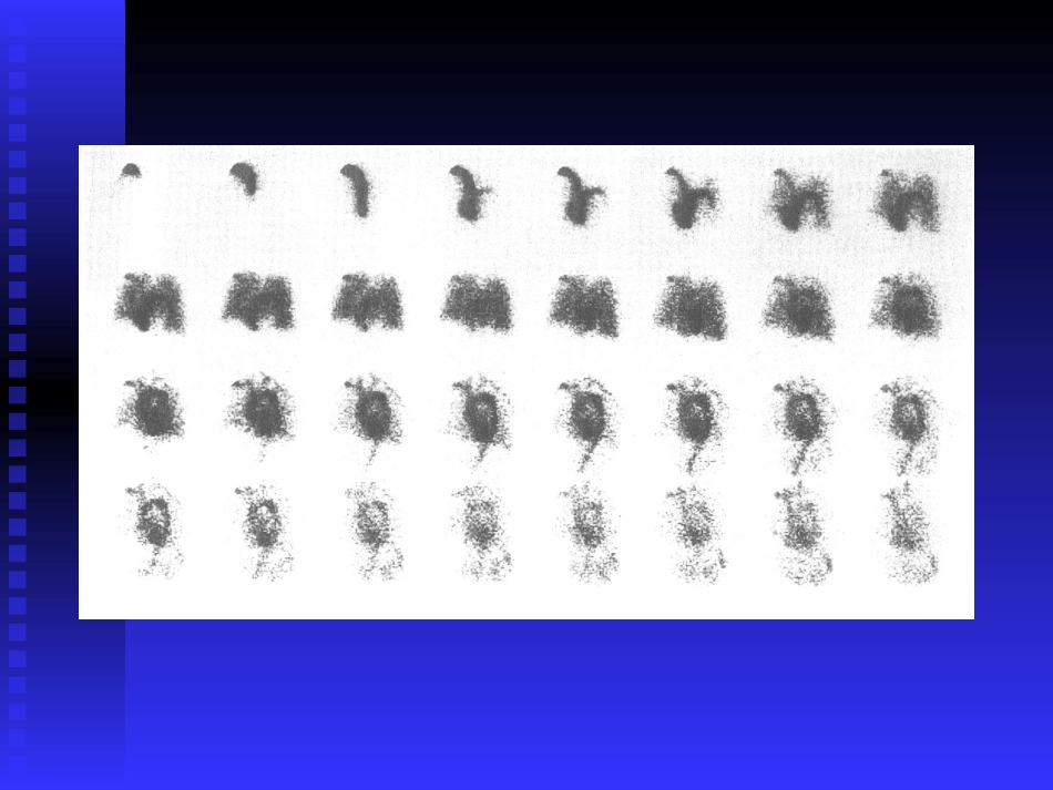 心血池显像和心功能测定李亚明.ppt_第3页