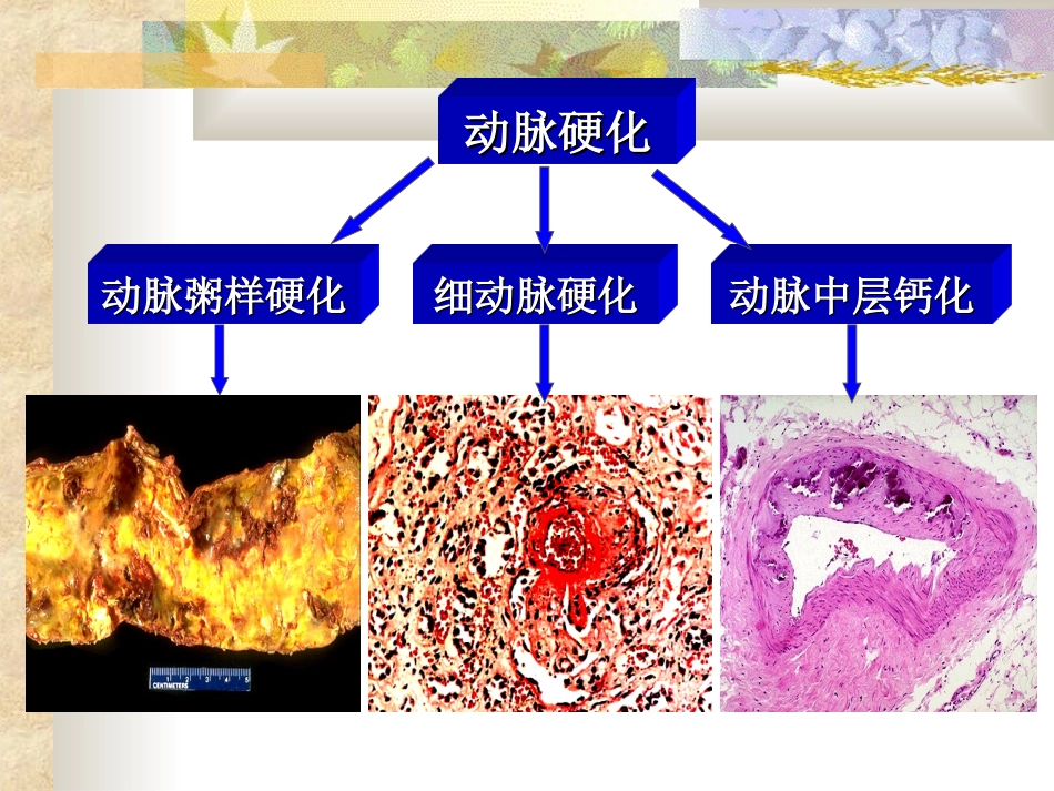 心血管研究生-jian.ppt_第3页