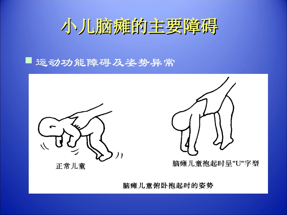 小儿脑瘫康复.ppt_第2页