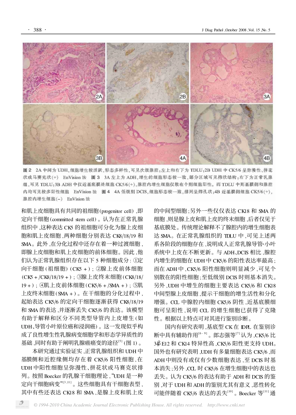 CK5-6在乳腺导管内增生性病变中的表达及意义.pdf_第3页