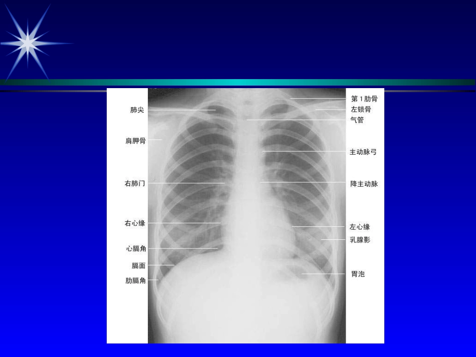 心脏望触叩.ppt_第3页