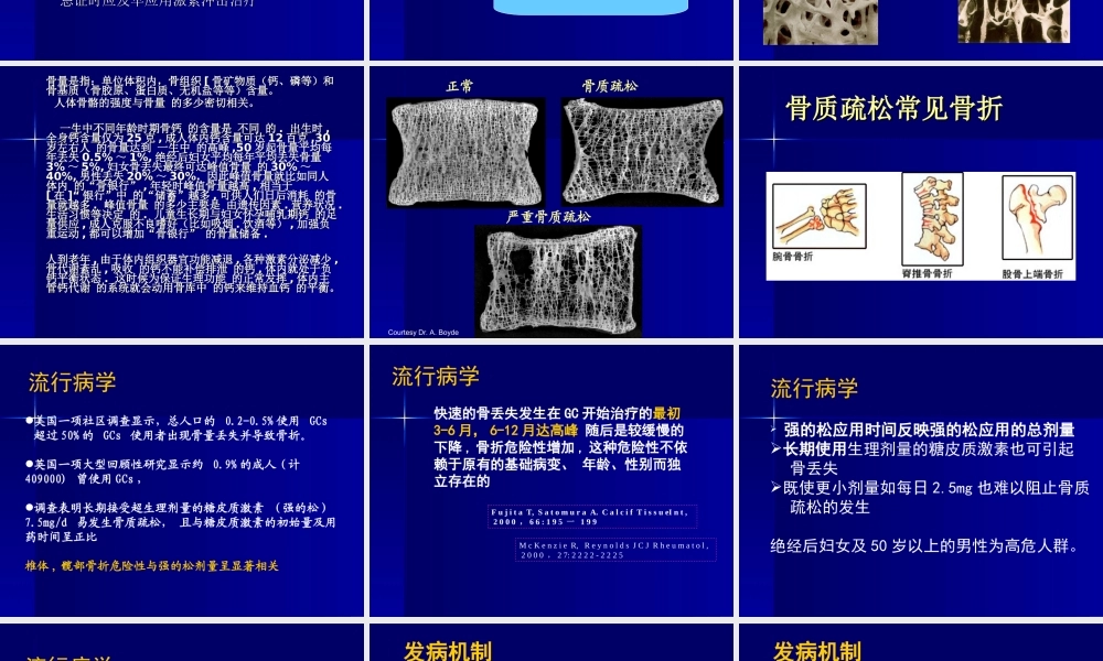 糖皮质激素性骨质疏松.ppt