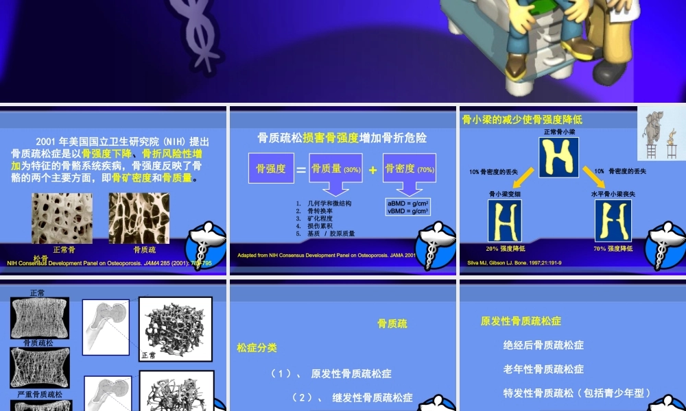 糖皮质激素所致骨质疏松症.ppt