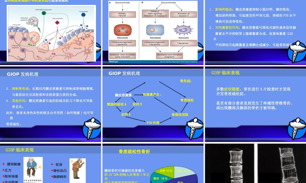 糖皮质激素所致骨质疏松症.ppt
