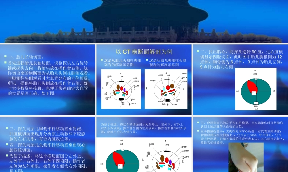 胎儿心脏检查步骤.ppt