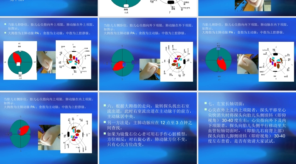 胎儿心脏检查步骤.ppt