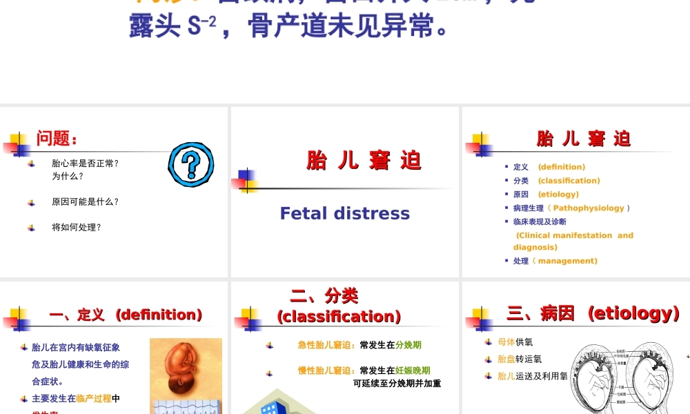 胎儿窘迫.ppt