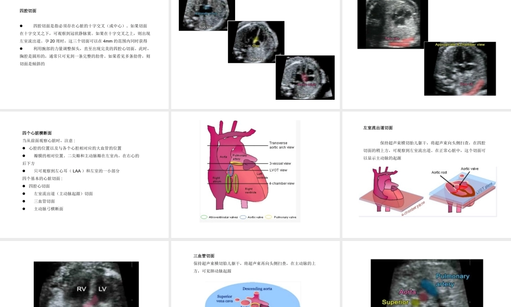 胎儿超声心动图讲座(如何获得胎儿心脏切面).ppt.ppt