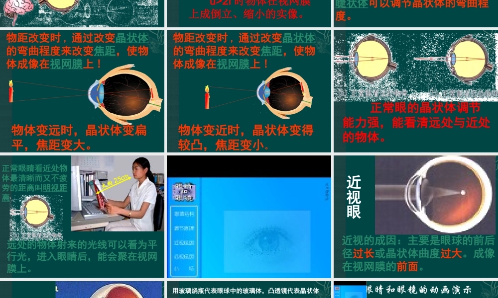 眼睛与视力矫正666.ppt