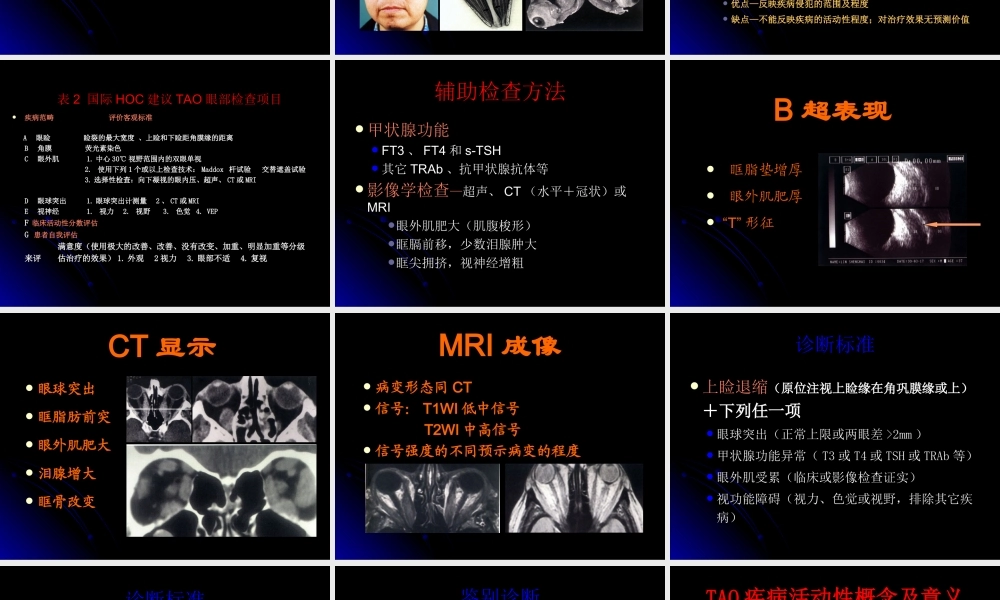 眼科甲状腺相关眼病.ppt