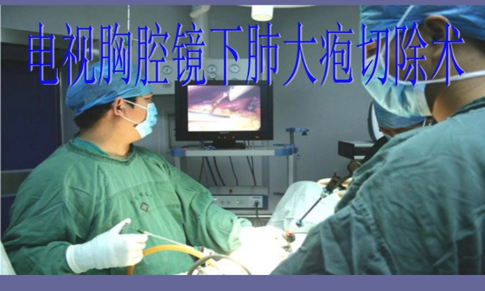 电视胸腔镜下肺大疱2.ppt