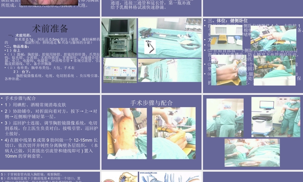 电视胸腔镜下肺大疱2.ppt