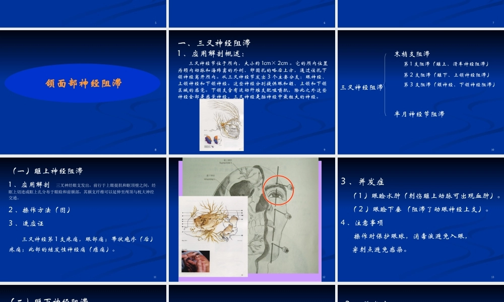 神经阻滞在疼痛科应用.ppt