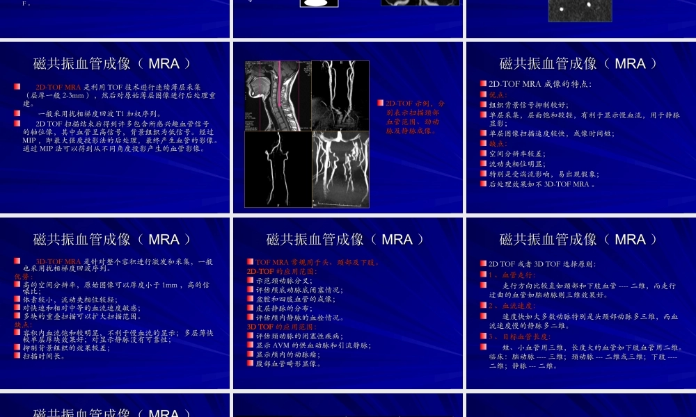 浅谈磁共振血管成像(MRA).ppt