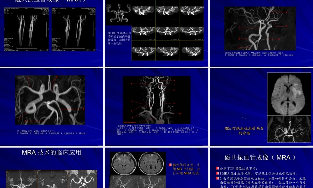 浅谈磁共振血管成像(MRA).ppt