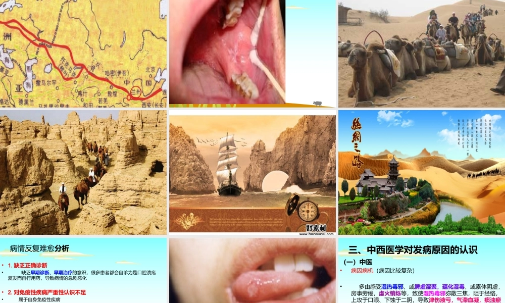 浅谈狐惑病-2.ppt