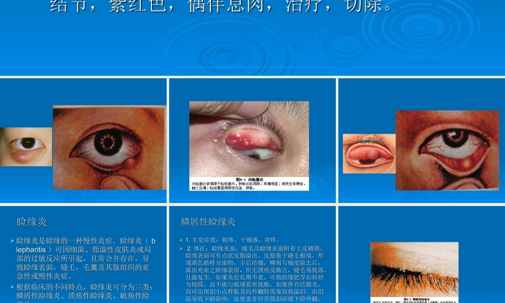 眼睑病与泪器病.ppt