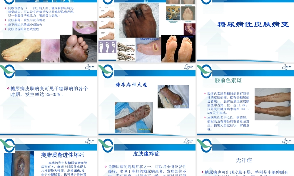 糖尿病足及皮肤病变.ppt