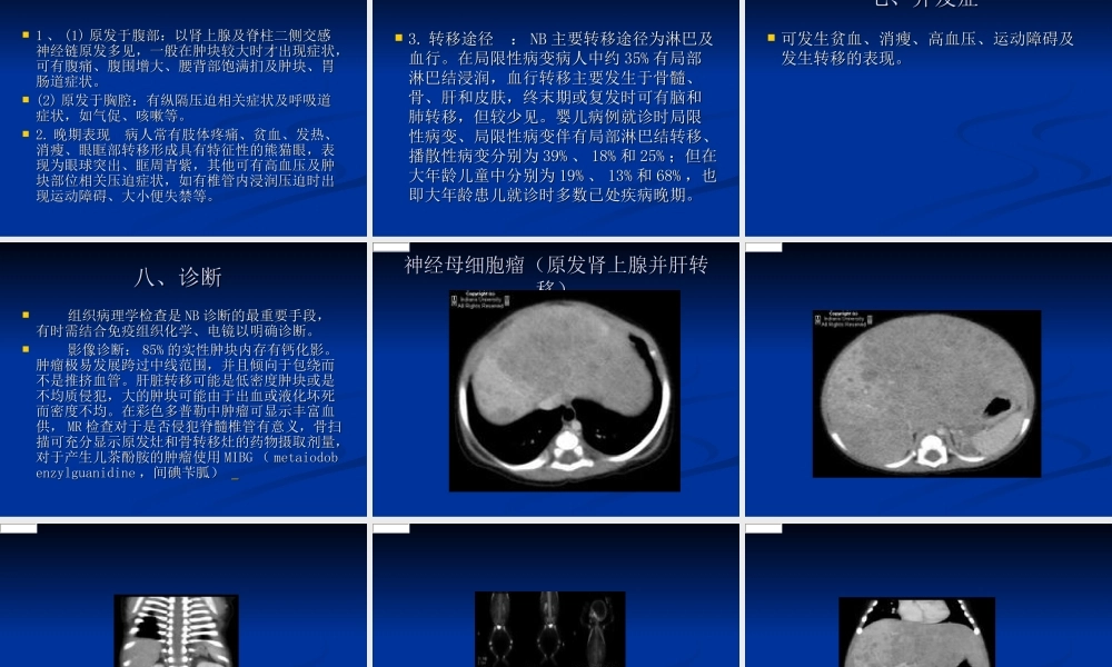 神经母细胞瘤.ppt