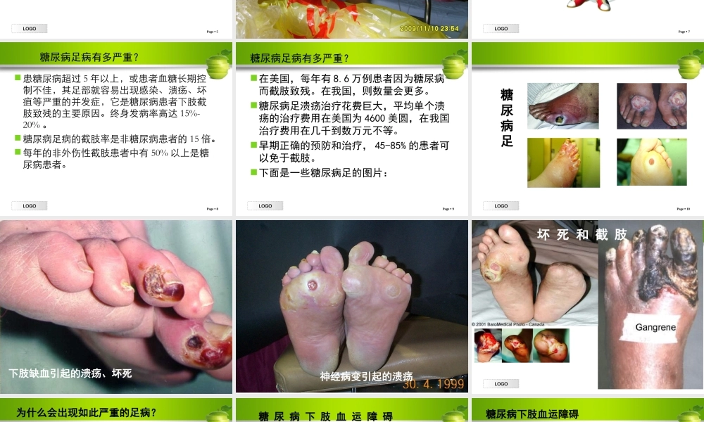 糖尿病足个案查房1.ppt