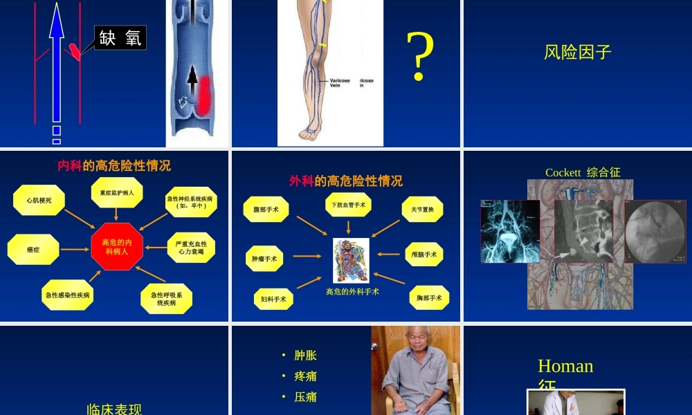 深静脉血栓防治策略..ppt
