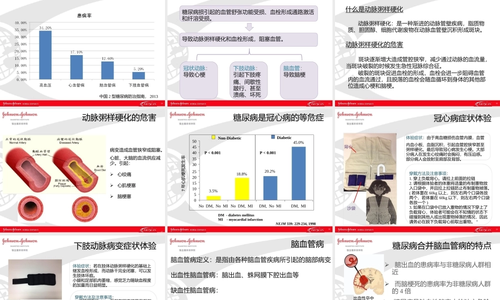 糖尿病并发症体验教具教学.pptx