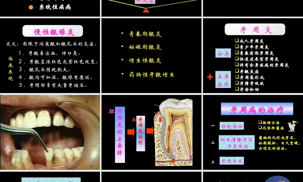 牙周口腔粘膜病.ppt
