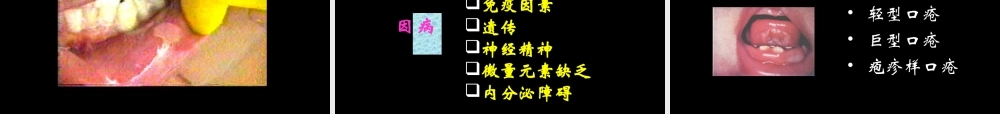 牙周口腔粘膜病.ppt