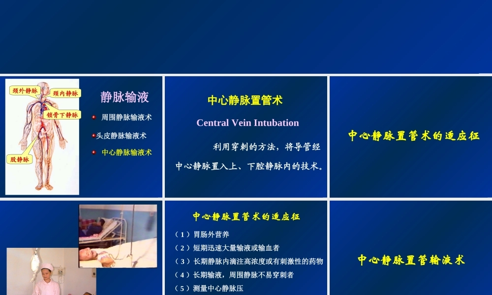 深静脉输液.ppt