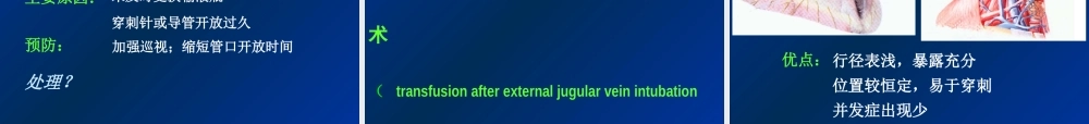 深静脉输液.ppt