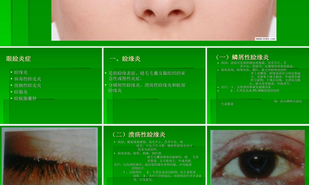 眼睑病-(1)幻灯片.ppt