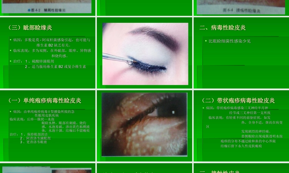 眼睑病-(1)幻灯片.ppt