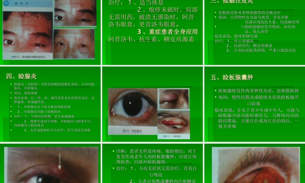 眼睑病-(1)幻灯片.ppt