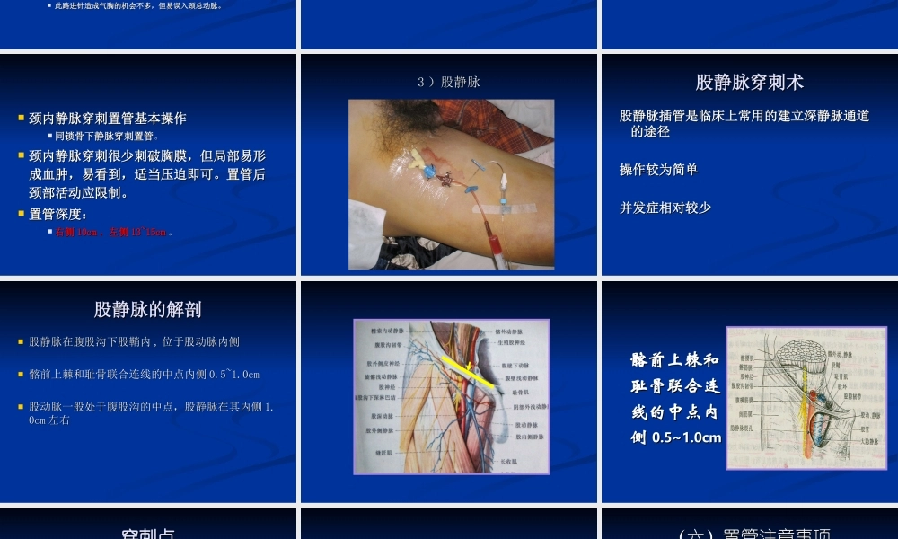 深静脉穿刺置管术(2).ppt
