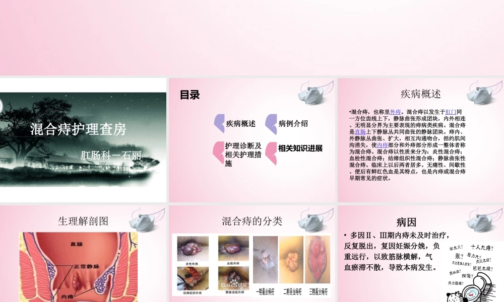 混合痔查房.ppt.ppt