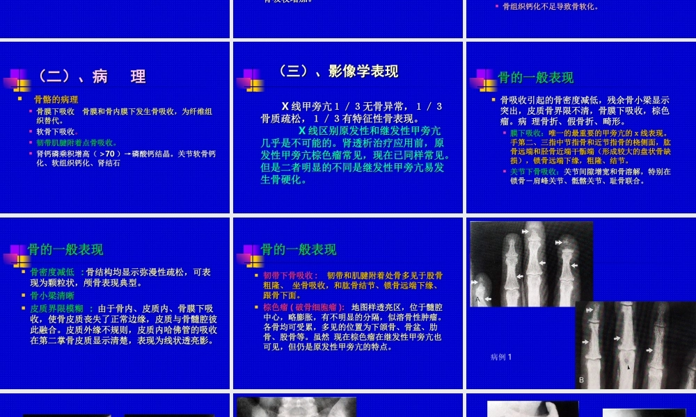 甲状旁腺功能亢进的骨骼影像学.ppt