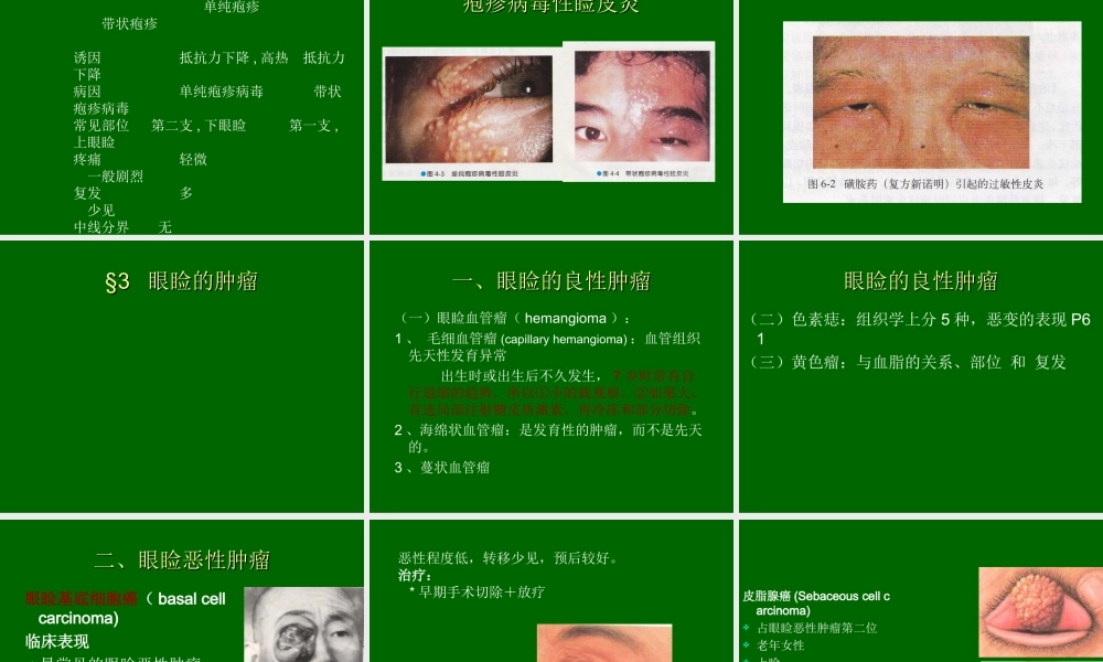 眼睑-泪器病.ppt