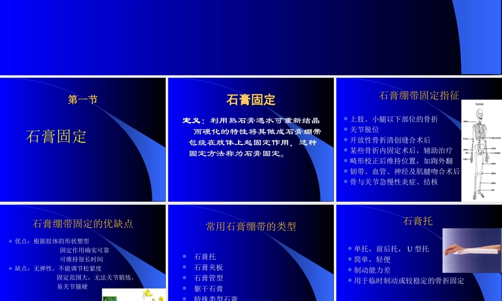石膏、夹板-骨牵引固定技术.ppt